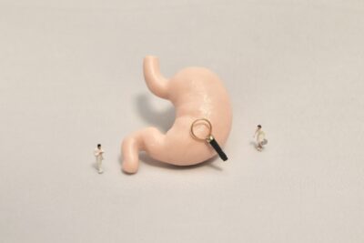 胃がんのセルフチェック|胃がんの早期発見・早期治療のために【江東区の消化器内科 豊洲ベイサイド内科外科】のアイキャッチ画像